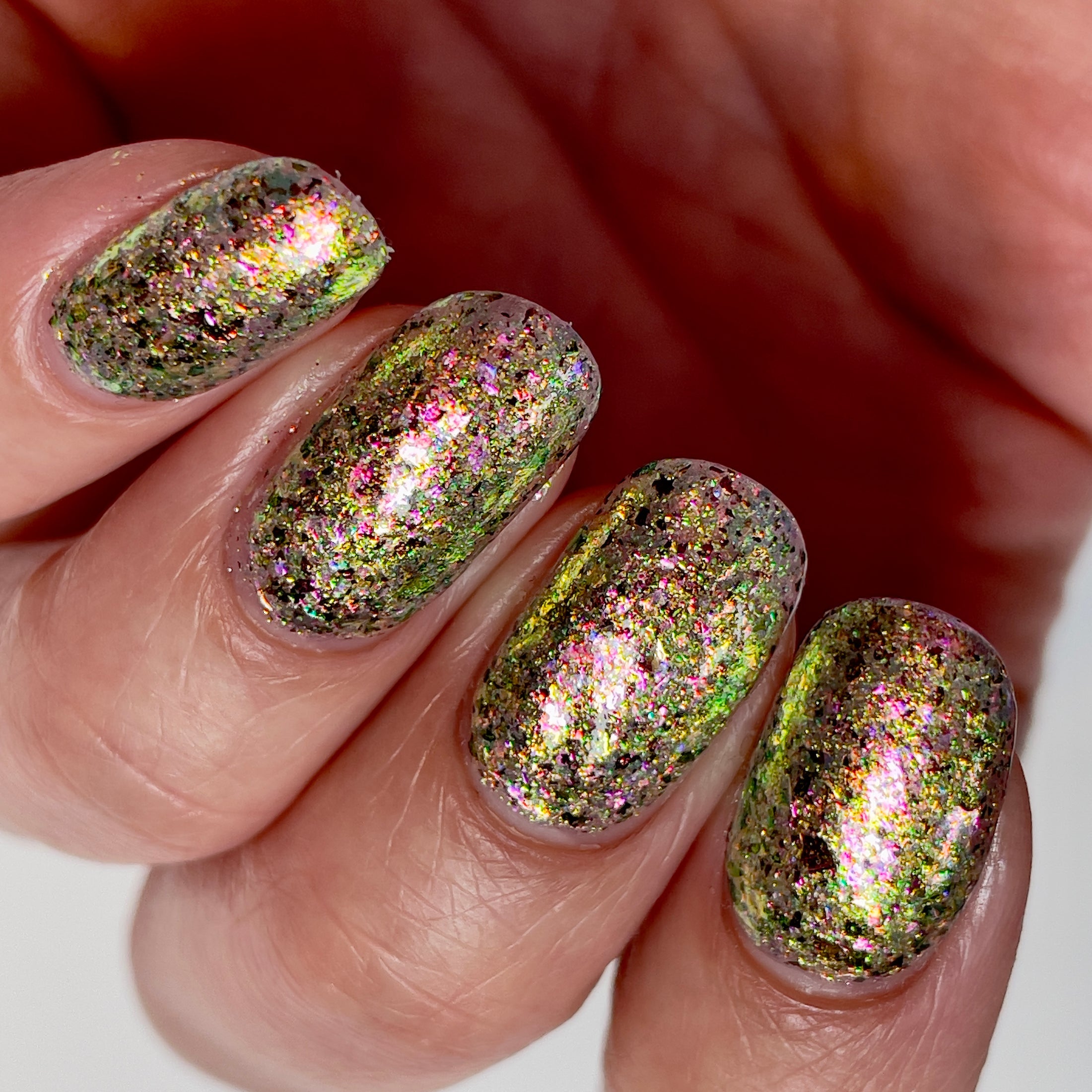 Ayla the Scoliosis Dolphin